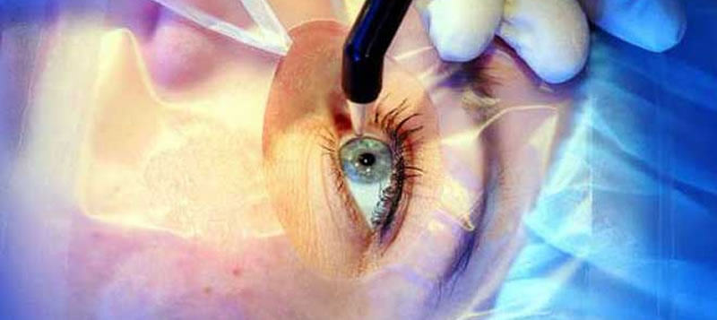 Corneal Disorders, therapy and transplantation